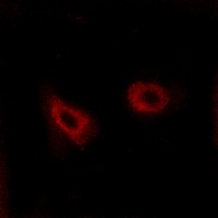 CMKLR1 Rabbit Polyclonal Antibody