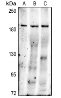 MRP2 Rabbit Polyclonal Antibody