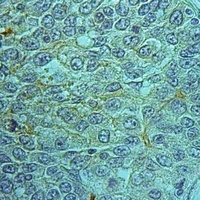 MRP2 Rabbit Polyclonal Antibody