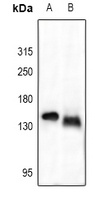 Collagen 1 alpha 2 Antibody