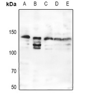 Collagen 3 alpha 1 Antibody