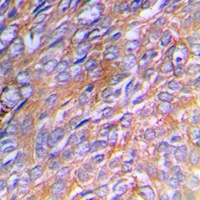 Collagen 3 alpha 1 Antibody