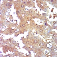Collagen 3 alpha 1 Antibody