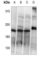 Collagen 5 alpha 1 Antibody