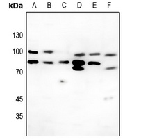 Collagen 6 alpha 2 Antibody