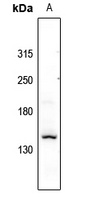 Collagen 11 alpha 1 Rabbit Polyclonal Antibody
