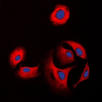 Collagen 11 alpha 1 Rabbit Polyclonal Antibody