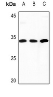 COMT Rabbit Polyclonal Antibody