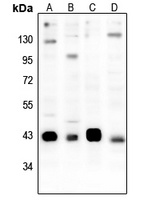 CREB (Phospho-S133) Antibody