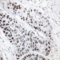 ATF2 (Phospho-S498) Rabbit Polyclonal Antibody