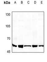 ATF2 Rabbit Polyclonal Antibody