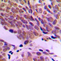 ATF2 Rabbit Polyclonal Antibody