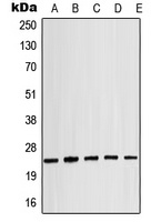 Alpha-crystallin B (Phospho-S19) Rabbit Polyclonal Antibody