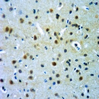 Alpha-crystallin B (Phospho-S19) Rabbit Polyclonal Antibody