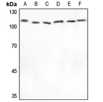XPO2 Antibody [KO/KD Validated]