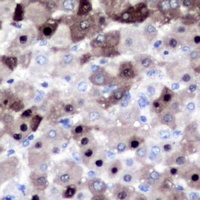 XPO2 Antibody [KO/KD Validated]