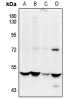 CSK (Phospho-S364) Rabbit Polyclonal Antibody
