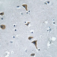 CSK (Phospho-S364) Rabbit Polyclonal Antibody