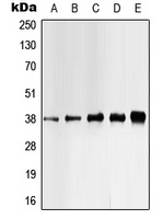 CK1 alpha (Phospho-Y321) Rabbit Polyclonal Antibody