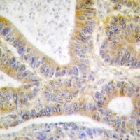 CK1 alpha (Phospho-Y321) Rabbit Polyclonal Antibody