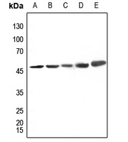 CK1 delta Rabbit Polyclonal Antibody