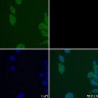 CK1 delta Rabbit Polyclonal Antibody