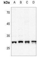 CK2 beta (Phospho-S209) Rabbit Polyclonal Antibody