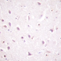 CK2 beta (Phospho-S209) Rabbit Polyclonal Antibody