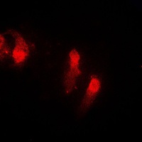 Cystatin B Rabbit Polyclonal Antibody