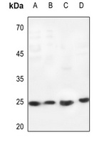 Cardiotrophin-1 Antibody