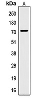 CTPS Rabbit Polyclonal Antibody