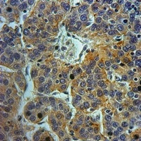 Cathepsin D HC Rabbit Polyclonal Antibody