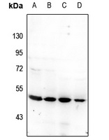 Cytochrome P450 2D6 Rabbit Polyclonal Antibody