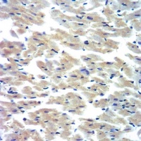 Cytochrome P450 2D6 Rabbit Polyclonal Antibody