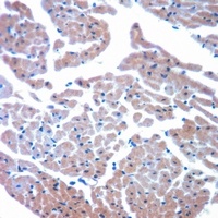 Cytochrome P450 8B1 Rabbit Polyclonal Antibody