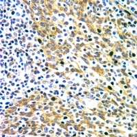 DAB1 Rabbit Polyclonal Antibody