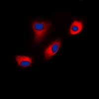 DAB1 Rabbit Polyclonal Antibody