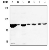 DAXX Rabbit Polyclonal Antibody