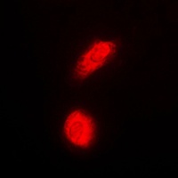 DAXX Rabbit Polyclonal Antibody