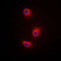 TRP2 Rabbit Polyclonal Antibody