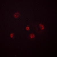GADD153 (Phospho-S30) Antibody