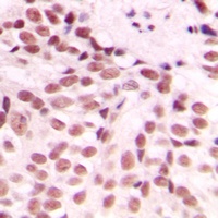 GADD153 Antibody