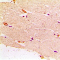Desmin Rabbit Polyclonal Antibody