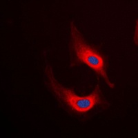 Desmin Rabbit Polyclonal Antibody