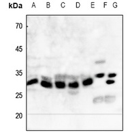 NQO1 Rabbit Polyclonal Antibody