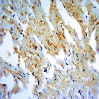 NQO1 Rabbit Polyclonal Antibody