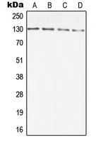DIAPH2 Antibody