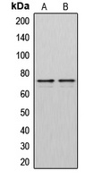 DMPK Rabbit Polyclonal Antibody