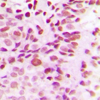 DNMT3B Rabbit Polyclonal Antibody