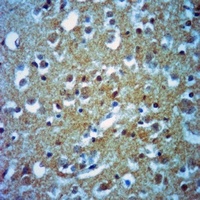 DSCR1 Antibody